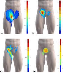 בקע ספורטאים 1
